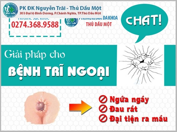  Trĩ ngoại hình thành bên ngoài hậu môn nên dễ nhận biết