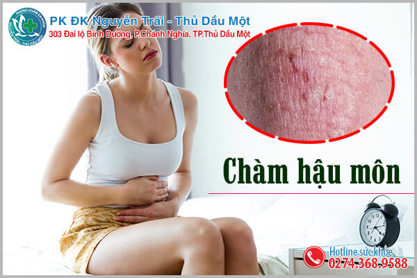 Triệu chứng bệnh chàm hậu môn xuất hiện như thế nào?