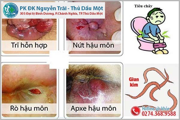 Ngứa hậu môn cảnh báo bệnh gì?